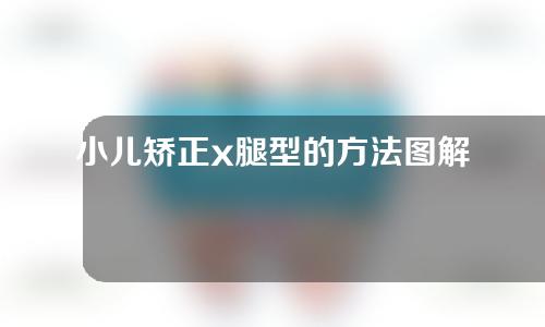 小儿矫正x腿型的方法图解