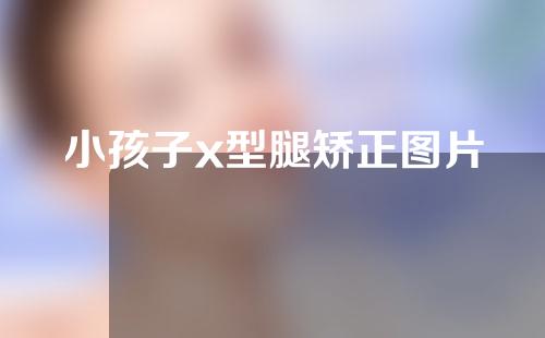 小孩子x型腿矫正图片