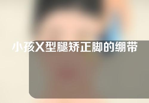 小孩X型腿矫正脚的绷带