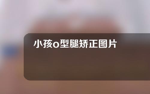 小孩o型腿矫正图片