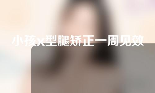 小孩x型腿矫正一周见效