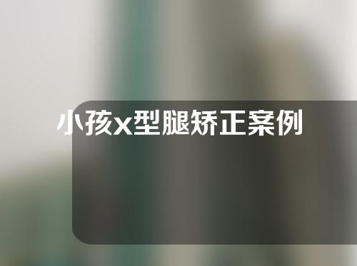 小孩x型腿矫正案例