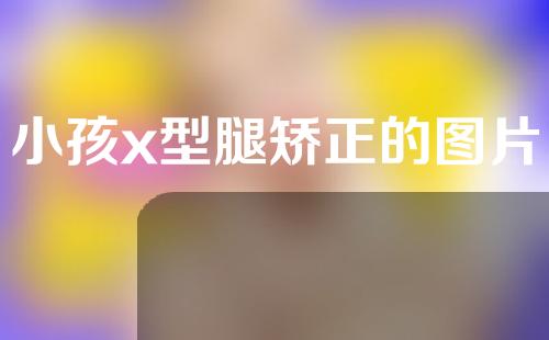 小孩x型腿矫正的图片