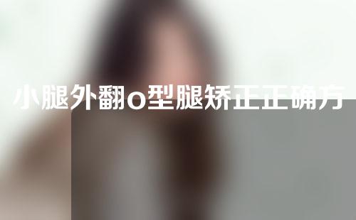 小腿外翻o型腿矫正正确方法