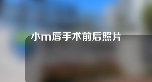 小m唇手术前后照片