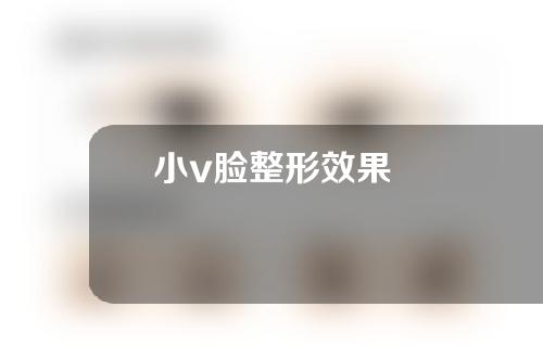 小v脸整形效果