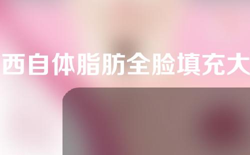 广西自体脂肪全脸填充大概需要多少钱(广西医科大自体脂肪填充)