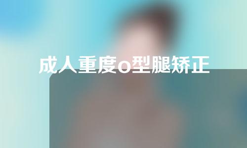 成人重度o型腿矫正