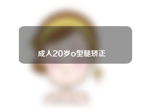 成人20岁o型腿矫正