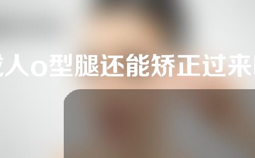 成人o型腿还能矫正过来嘛