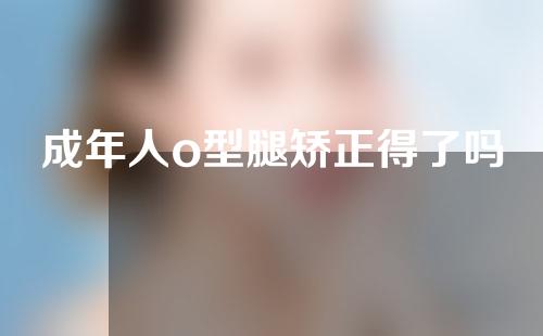 成年人o型腿矫正得了吗