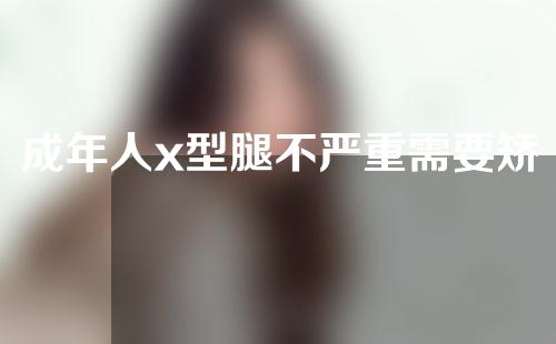 成年人x型腿不严重需要矫正吗