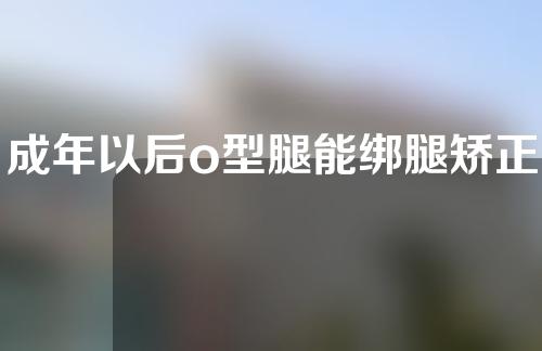 成年以后o型腿能绑腿矫正吗