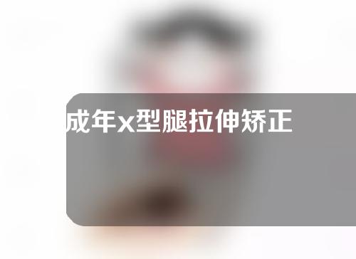 成年x型腿拉伸矫正