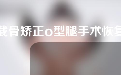 截骨矫正o型腿手术恢复
