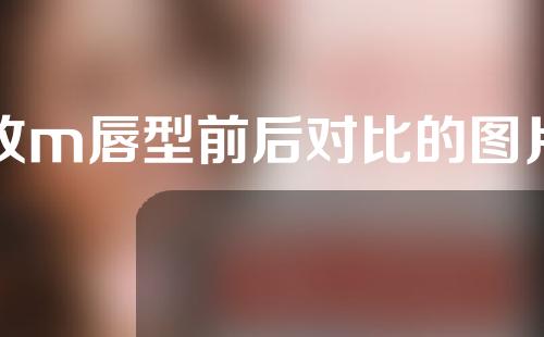 改m唇型前后对比的图片