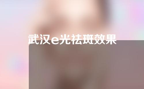 武汉e光祛斑效果