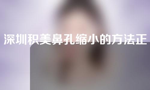 深圳积美鼻孔缩小的方法正规吗