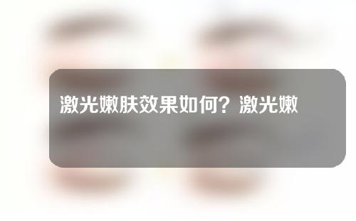 激光嫩肤效果如何？激光嫩肤副作用大吗？