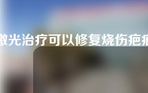 激光治疗可以修复烧伤疤痕