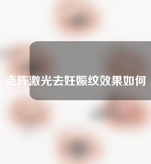 点阵激光去妊娠纹效果如何