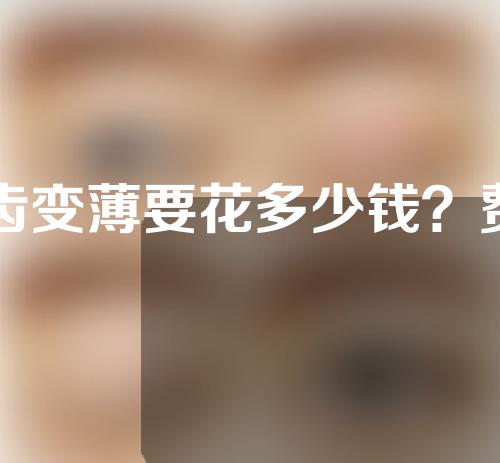 牙齿变薄要花多少钱？费用是多少？