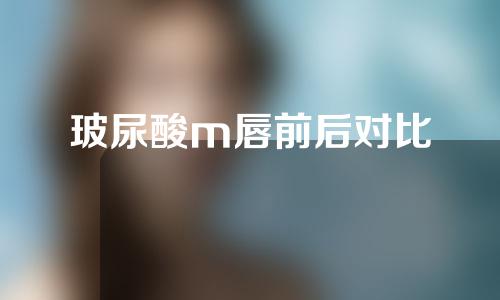 玻尿酸m唇前后对比