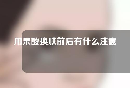 用果酸换肤前后有什么注意事项？