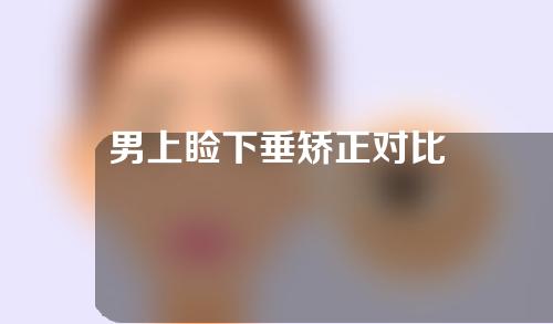 男上睑下垂矫正对比