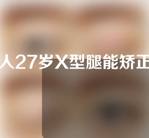 男人27岁X型腿能矫正过来吗