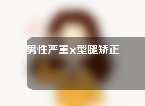 男性严重x型腿矫正