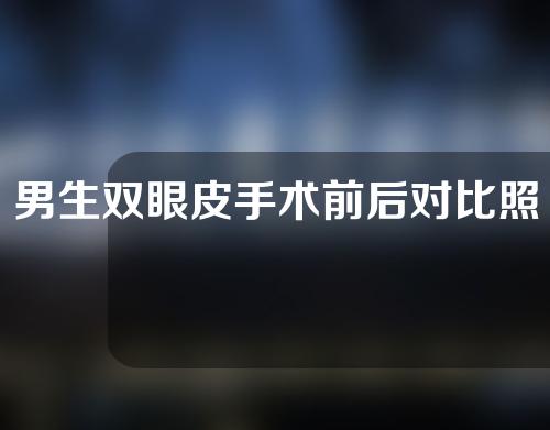 男生双眼皮手术前后对比照(男生双眼皮手术前后对比照片)
