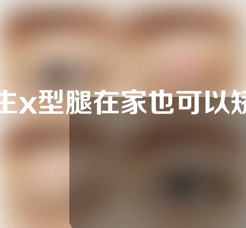 男生x型腿在家也可以矫正