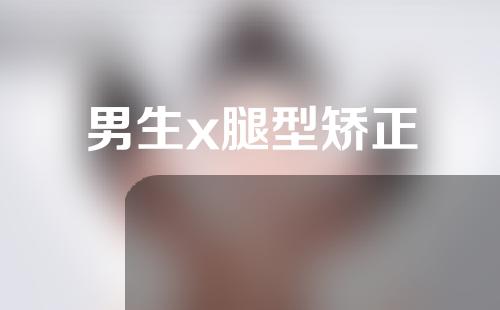 男生x腿型矫正