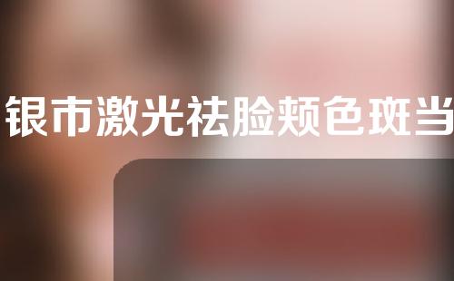 白银市激光祛脸颊色斑当地知名医院名单分享