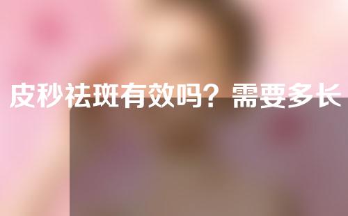 皮秒祛斑有效吗？需要多长时间？_1