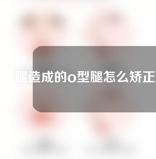 盘腿造成的o型腿怎么矫正