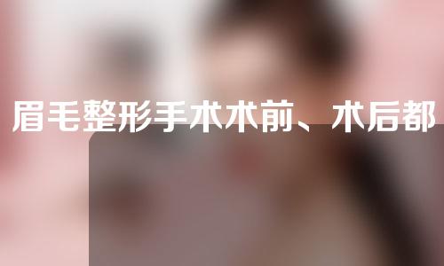 眉毛整形手术术前、术后都要注意些什么呢？