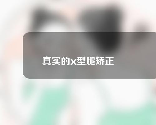 真实的x型腿矫正