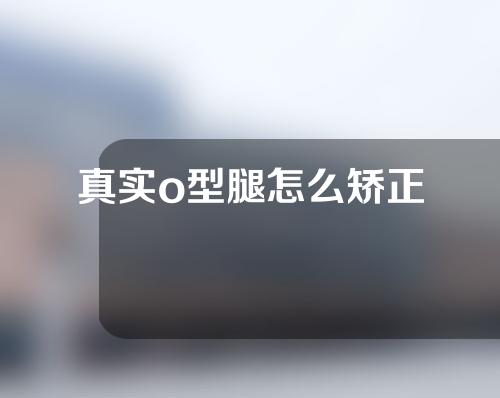 真实o型腿怎么矫正