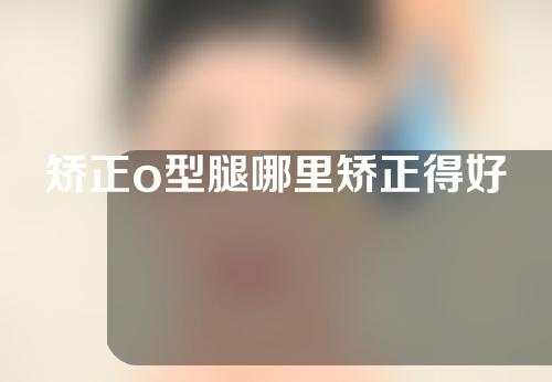 矫正o型腿哪里矫正得好