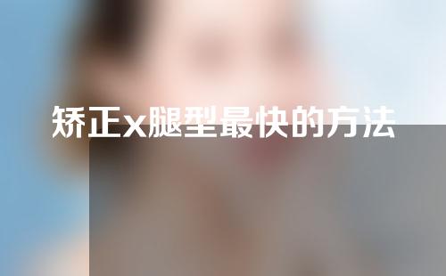 矫正x腿型最快的方法