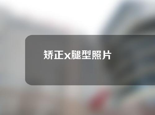 矫正x腿型照片