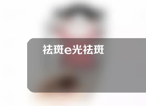 祛斑e光祛斑