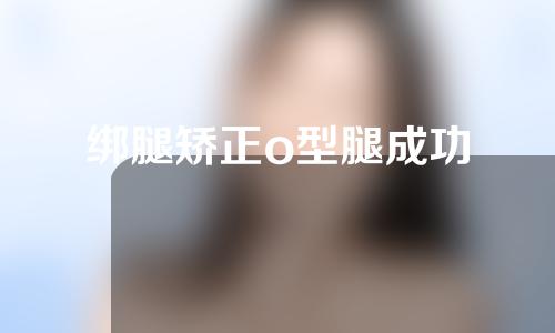 绑腿矫正o型腿成功