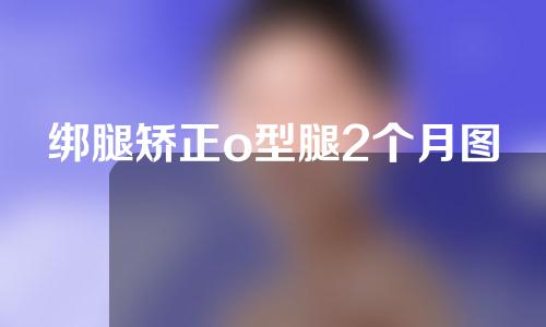 绑腿矫正o型腿2个月图