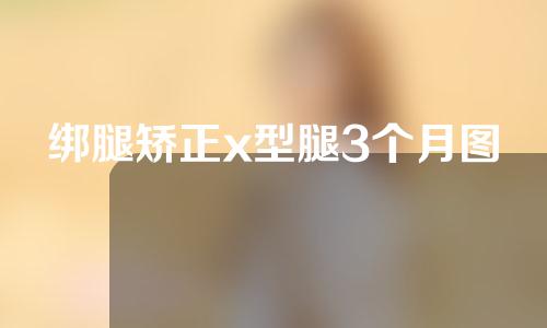 绑腿矫正x型腿3个月图