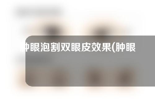 肿眼泡割双眼皮效果(肿眼泡割双眼皮效果图)