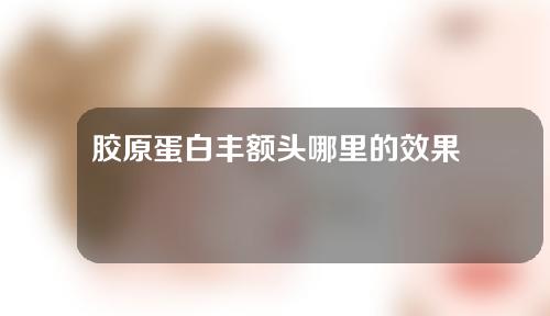 胶原蛋白丰额头哪里的效果好一些(胶原蛋白丰额头，祛除皱纹效果倍增！)