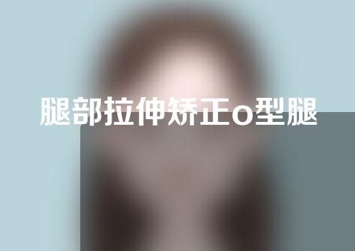 腿部拉伸矫正o型腿